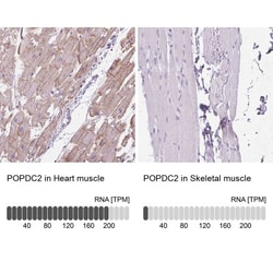 POPDC2 Antibody, Novus Biologicals 0.1 mL | Buy Online | Novus Biologicals | Fisher Scientific